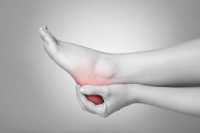 What Is the Definition of Plantar Fasciitis?